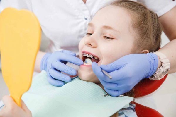 Best Dental Braces Specialists in Pune