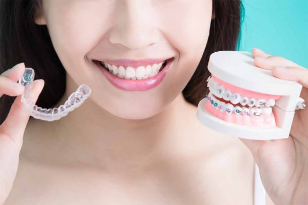 Best Dental Braces Specialists in Mumbai & Navi Mumbai