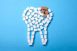 Enamel Erosion – Causes & Effects