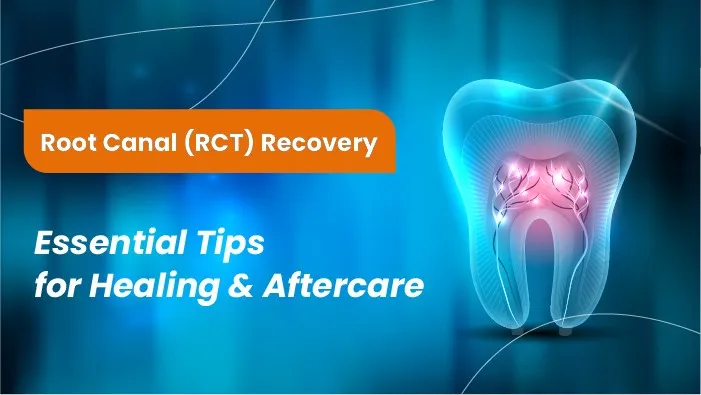 Root Canal (RCT) Recovery: Essential Tips for Healing and Aftercare